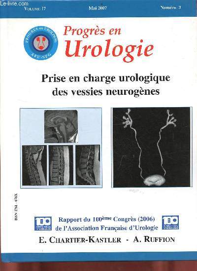 Progrs en Urologie volume 17 n3 mai 2007 - Prise en charge urologique des vessies neurognes - Rapport du 100me congrs (2006) de l'association franaise d'urologie.