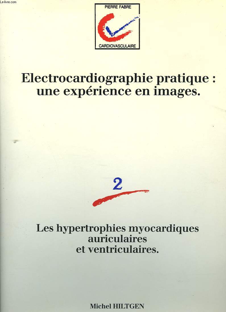 ELECTROCARDIOGRAPHIE PRATIQUE: UNE EXPERIENCE EN IMAGE. 2. Les hypertrophies myocardiques auriculaires et ventriculaires.