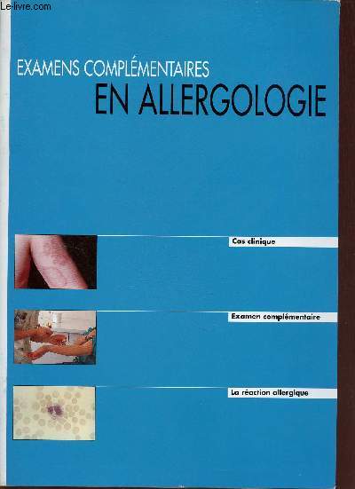 Examens complmentaires en allergologie - Cas clinique, examen complmentaire, la raction allergique.