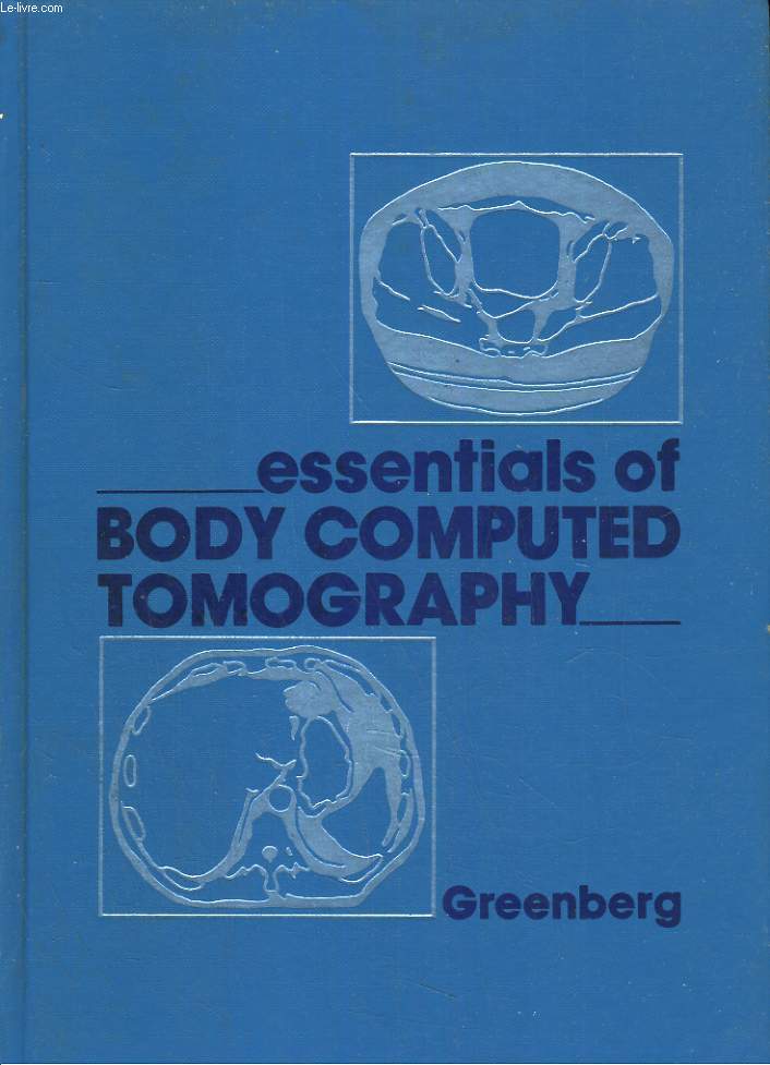 Essentials of body computed tomography