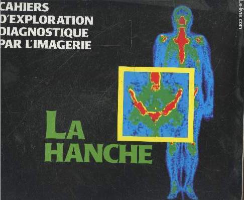 Cahiers d'exploration diagnostique par l'imagerie : La hanche