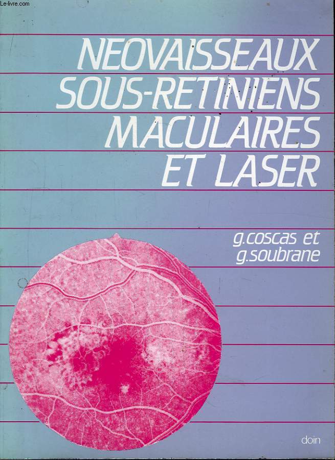 Novaisseaux sous-rtiniens maculaires et laser.